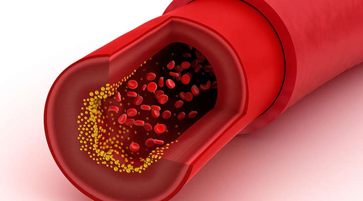 Querschnitt einer Arterie